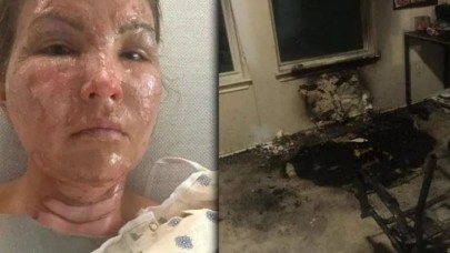Dezenfektan kullanıp mum yaktı,  bu hale geldi! Uzmanlar uyardı