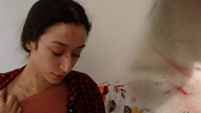 Eşinden şiddet gören Buse'nin yardım çığlığı: Bebeğimi 12'nci katın balkonundan sarkıttı