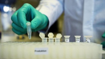 Oxford Üniversitesi'nin koronavirüs aşısı yıl sonundan önce hazır olabilir