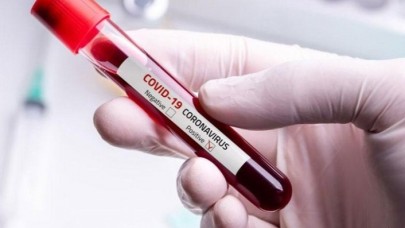 Şoke eden 'koronavirüs' tespiti: Pozitif sonuçlar sisteme girilmedi