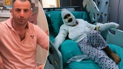 Yüzüne kızgın yağ döken erkek arkadaşı ceza alınca Kübra Tayfur ağladı