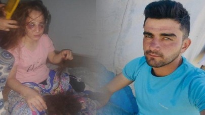 Eşine işkence yaptı,  serbest kaldı: 'Ne oldu tutuklatabildiniz mi?'