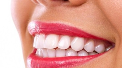 Gülüş Tasarımı İle Siz De Kusursuz Gülümsemenize Kavuşun