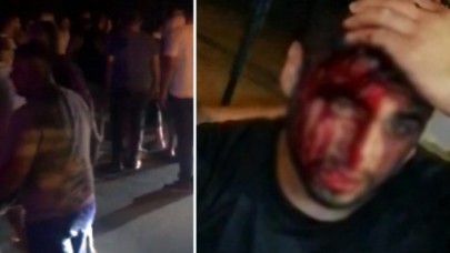 Sigara içmek için çakmağını çakan genci tekme tokat dövdüler