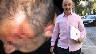 Kaşıbeyaz Restoran'ın ortağı Suat Kaşıbeyaz'a hastanede dayak!