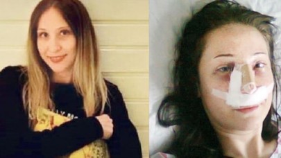 Burun estetiği ameliyatı olan Sevinç Çelik'in hayatı karardı!