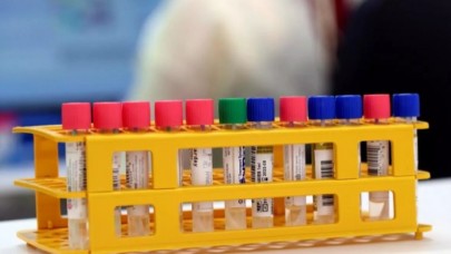 Valilik duyurdu: Şehir dışından gelenlere test kararı