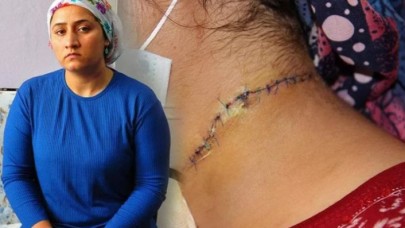 Eşi tarafından boğazı kesilen Esra Oymak: Tahliye edilmesin