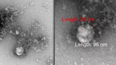 İşte mutasyonlu koronavirüsün ilk fotoğrafı!