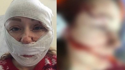 Kocaeli'de dehşet: Mesut Öztürkmen,  eşi Anna Butim'e falçata ile saldırdı: Görüntüler görenlerin içini sızlattı