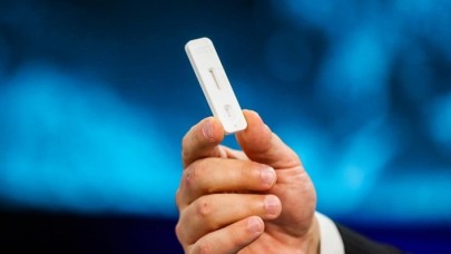 Türk mühendislerin Kovid-19 tanı kitine dünyadan yoğun ilgi