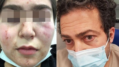 Alman polisi Türk baba ile kızına şiddet uyguladı