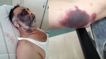 Darp edilen yüzde 90 engelli Mümin Kara hayatını kaybetti