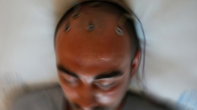 Nöbet geçiren epilepsi hastalarına 'yanlış müdahale' uyarısı