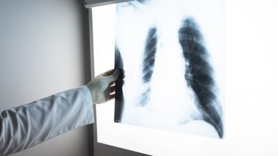 Sigara akciğere kızgın bir iğnenin batması gibi zarar veriyor