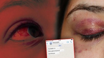 Avukattan genç kadına şiddet: Pide mesajı şaşkına çevirdi