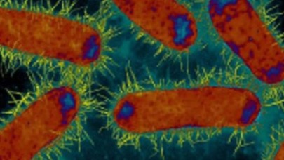 Koronavirüs hastası 3 kişide NDM-1 bakterisi tespit edildi!