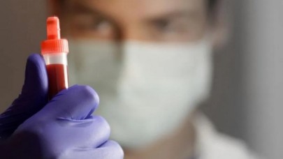 Koronavirüsü atlatanlar dikkat! Antikor kaç ay koruyor?