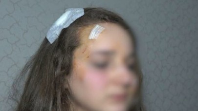 Muşta ile genç kızı acımazsızca darp etti: 'Abimi öldüren kıza benzettim' dedi