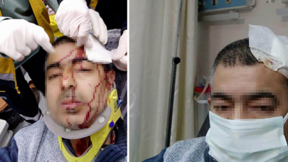 İmamdan müezzine sabah namazı sonrası öldüresiye dayak