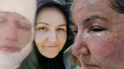 Diyarbakır'da korkunç olay: Cani adam çocuklarının gözü önünde eşini kızgın yağ ve kaynar su ile haşladı