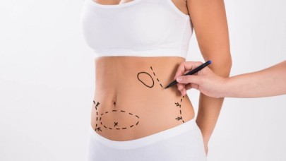 Liposuction Nedir? – Op. Dr. Ozan Balık