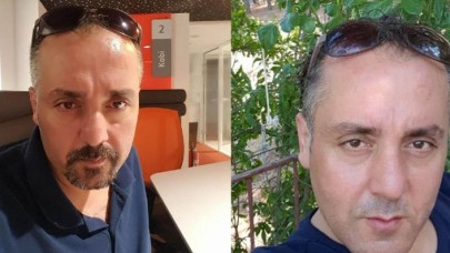 Eski kız arkadaşı yüzüne kezzap atmıştı! Gürkan Karpuzoğlu ölü bulundu