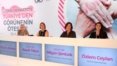 Türkiye'de ilk kez yapılan 'atopik dermatit' araştırmasının sonuçları paylaşıldı