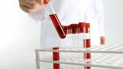 Bu kan grubunda olanlar yaşadı: Hastalıklar onları daha az etkiliyor