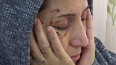 Hatay'da vahşet: Elini öpmeyen yeğenini dövdü,  abi demeyen yengesi Mehtap İlgar'ı 50 kez bıçakladı
