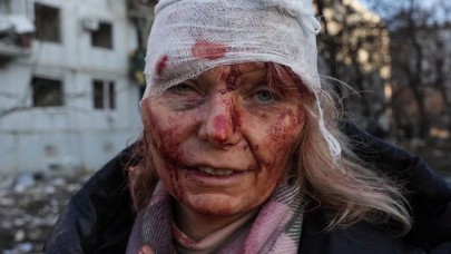 Rusya kentleri vuruyor! Ukrayna'da son durum: Kan,  vahşet,  gözyaşı