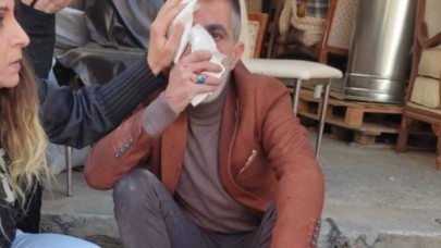 Mersin'de yine  gazeteciye saldırı: Bıçakla sladırdılar, burnunu kırdılar!