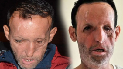 Yüz nakli yapılan Recep Sert gözaltına alında: Hakkındaki suçlamalar çok ciddi!