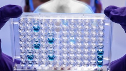 Araştırma: Küresel ısınma 4 bin virüsün memeliler arasında yayılmasına sebep olacak