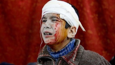 Bomba içinde bomba!Misket bombalarından zarar görenlerin yarıya yakını çocuk
