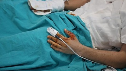 Evdeki anlık dikkatsizlik hasarı ömür boyu taşınabilecek ağır yanıklara yol açabiliyor