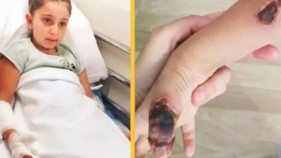 Hastahanede akıl almaz olay: Minik Elif'i MR'da yaktılar!