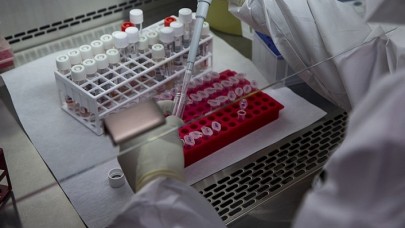 DSÖ: Maymun çiçeği salgınının merkez üssü Avrupa