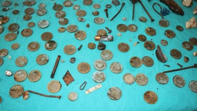 Midesi malzeme çantasını aratmadı! 233 parça yabancı cisim çıkartıldı