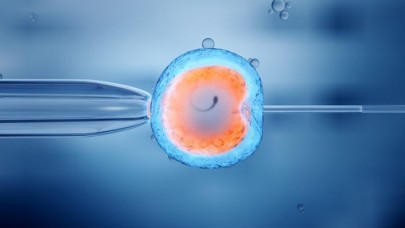 Tüp Bebek Tedavisi Nasıl Yapılır?