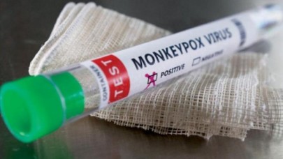 Uzmanlar belirtilerle ilgili konuştu: Maymun çiçeği ile ilgili korkutan uyarı