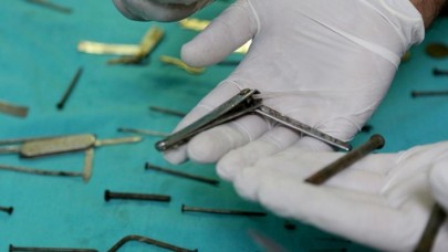 Van'da kadın hastanın midesinden 158 yabancı cisim çıkarıldı