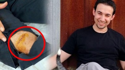 Sağlık çalışanı Kaan Kanat'ın dizine makas saplayan saldırgan serbest bırakıldı