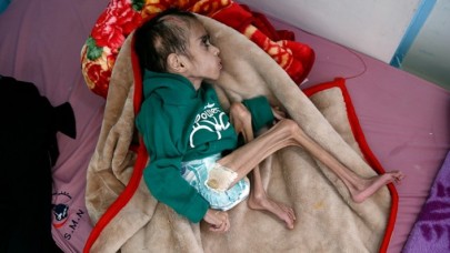 İnsan hakları savunucuları BM ve AB sınıfta kaldı! Yemen'de insani kriz!