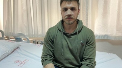 İzmir'de Suriyeli adam 'Karıma bakamazsın' dedi,  doktor Mücahit Furkan Balcı'nın burnunu kırdı