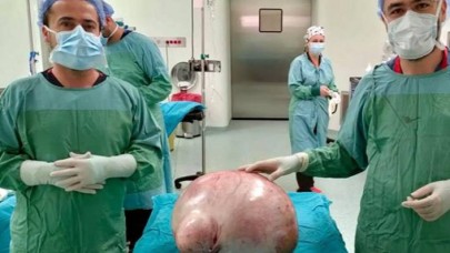Kadın hastanın karnından 35 kilogramlık kitle çıkarıldı