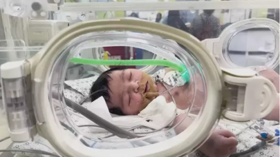 Dünya 'mucize bebek' olarak ondan bahsediyor!