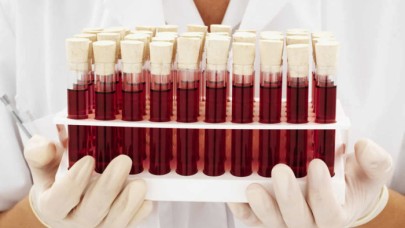 Bilim dünyası son noktayı koydu: İşte en zeki insanların kan grubu!