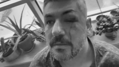 Büyükçekmece'de okul müdürü öğrencilerini dövdü. 'Çocuğumu niye dövdün' diyen veli Hakan Utanc'ı da hastanelik etti