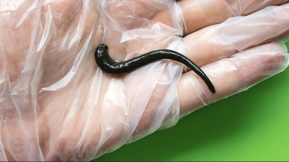 Sülükler ilham kaynağı oldu! Kan alma çilesi son buluyor